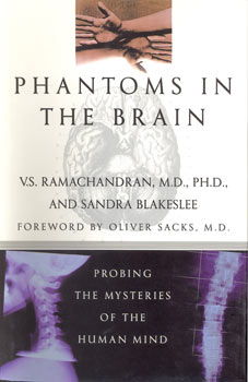 Phantoms in the Brain